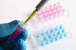 痛心！《柳葉刀》 一年新增30萬年輕癌癥病人，4種癌奪走他們的生命